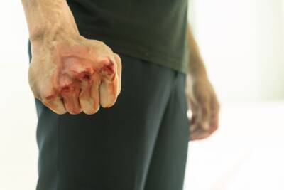 botte pugno sporco sangue