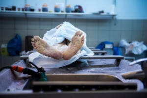 piedi di un cadavere in obitorio