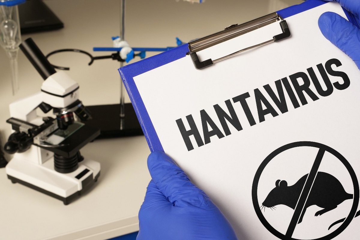 cartella per controlli per Hantavirus